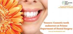 Veneers: Cosmetic teeth makeovers at Primus Department of Dental Surgery