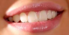 You will enjoy: Tooth Whitening (45 minutes) I'm sure you would agree that your smile is one of the first things people always notice. If you have dis-coloured teeth, it's very noticeable and can make you appear gloomy and not confident. So, by having your teeth whitened, it is going to boost your confidence and self-esteem. We are a mobile service so book an appointment today and we will visit you at your home.