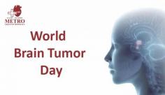 #BrainTumor is a type of cancer which is not common as majority of people are not aware about this lethal disease. The day aims to educate people about various symptoms and preventive measures regarding to the disease. 

https://goo.gl/bMCP5V