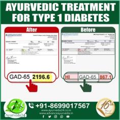 #Ayurvedic #treatment #Helps_to_normalize_Antibodies built up against #Pancreas. See the difference after just 3 months of ayurvedic treatment. 

#Ayurveda_Treatment_for_Type_1_Diabetes
#Can_long_term_type_1_diabetes_be_cured_through_Ayurveda
#Ayurvedic_herbs_for_diabetes
#Is_there_an_Ayurvedic_Treatment_for_Diabetes