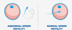 Finding a reliable fertility testing center is an important step for anyone looking to understand their reproductive health. Choosing a certified laboratory ensures accurate testing, professional support, and confidential services throughout the process. Trusted labs also provide timely reports that help individuals make informed healthcare decisions. Semen Analysis Lab Newyork City is a valuable search for those seeking dependable fertility testing with experienced laboratory professionals.A comprehensive semen analysis measures essential fertility factors, including sperm count, motility, morphology, semen volume, and overall sperm health. These results help healthcare providers identify potential fertility concerns and recommend appropriate treatment or lifestyle improvements. Early testing offers valuable insights that can support better reproductive planning and improve confidence throughout the fertility journey.